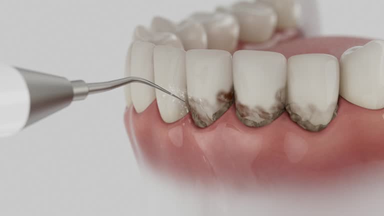 Reliable Dental Implants contractor in Carmichael, CA by Smile Center Dentistry